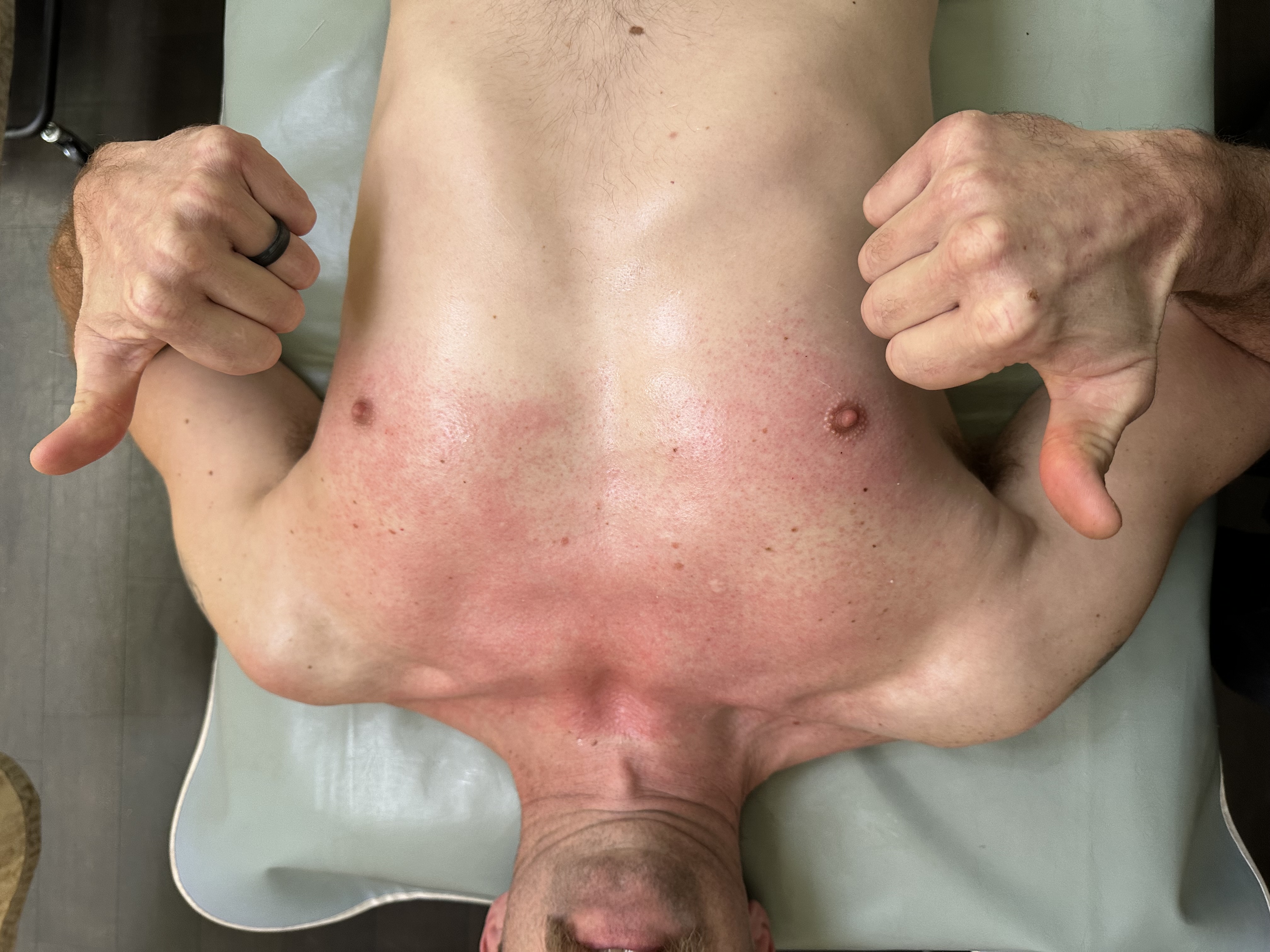Full Chest wax with a blend on the shoulders